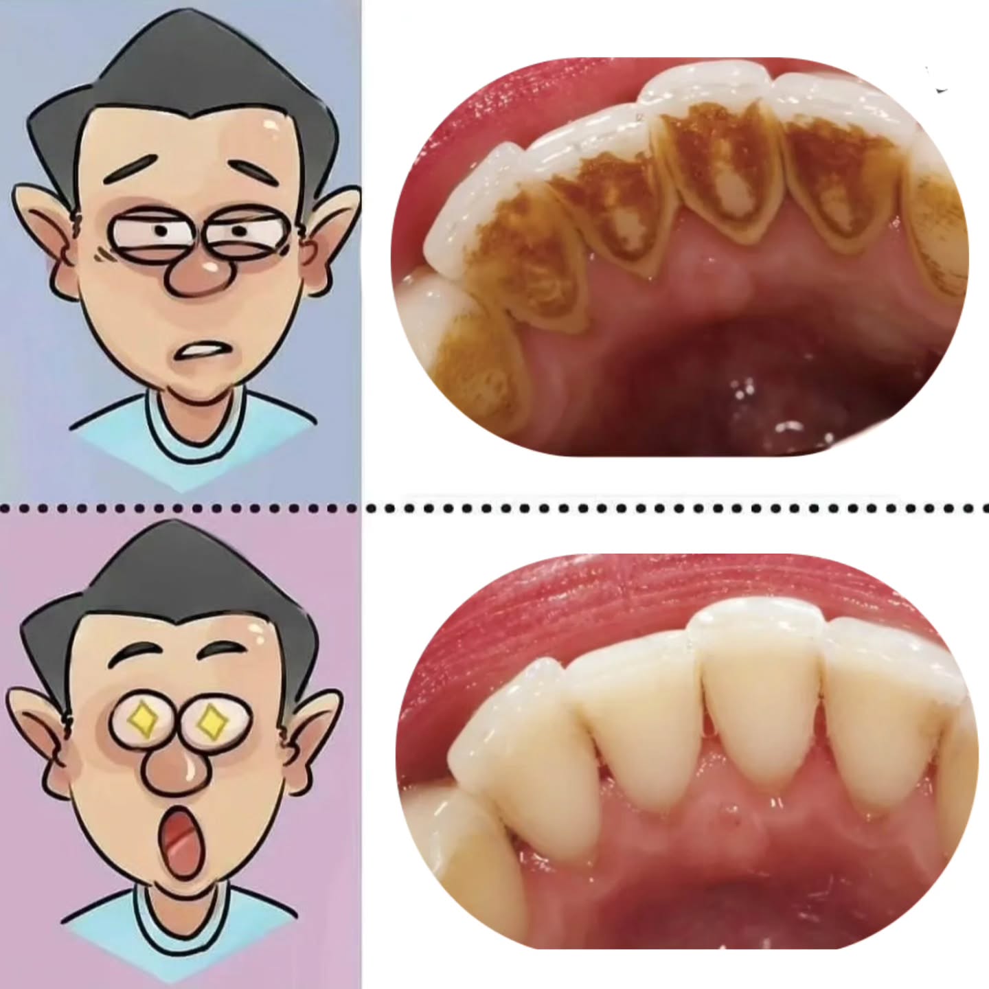 Smile Makeover Before/After